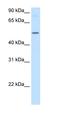 Betaine--Homocysteine S-Methyltransferase antibody, orb330184, Biorbyt, Western Blot image 