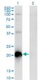 TCAP antibody, H00008557-M03, Novus Biologicals, Western Blot image 