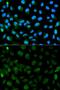 Promyelocytic Leukemia antibody, GTX55751, GeneTex, Immunofluorescence image 