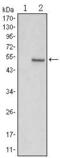 Polycomb protein SUZ12 antibody, MA5-15732, Invitrogen Antibodies, Western Blot image 