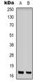 Interferon Induced Transmembrane Protein 1 antibody, LS-C368733, Lifespan Biosciences, Western Blot image 