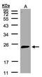 RAB2A, Member RAS Oncogene Family antibody, LS-B10828, Lifespan Biosciences, Western Blot image 