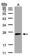 Ras-related protein Rab-2A antibody, LS-B10828, Lifespan Biosciences, Western Blot image 