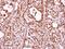 THO Complex 1 antibody, PA5-27816, Invitrogen Antibodies, Immunohistochemistry paraffin image 