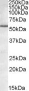 TAR DNA Binding Protein antibody, 46-778, ProSci, Enzyme Linked Immunosorbent Assay image 