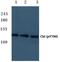 Cbl Proto-Oncogene antibody, PA5-36770, Invitrogen Antibodies, Western Blot image 