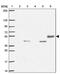 TRNA Splicing Endonuclease Subunit 54 antibody, PA5-62729, Invitrogen Antibodies, Western Blot image 