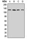 Leucine Rich Pentatricopeptide Repeat Containing antibody, LS-C668582, Lifespan Biosciences, Western Blot image 