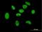 Zinc Finger Protein 189 antibody, H00007743-B01P, Novus Biologicals, Immunocytochemistry image 