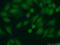 Proteasome Subunit Alpha 7 antibody, 15219-1-AP, Proteintech Group, Immunofluorescence image 