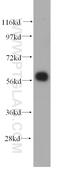 Rho Guanine Nucleotide Exchange Factor 5 antibody, 11379-1-AP, Proteintech Group, Western Blot image 