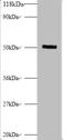 Matrix Metallopeptidase 1 antibody, A54041-100, Epigentek, Western Blot image 