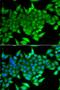 FOXE1 antibody, orb373740, Biorbyt, Immunofluorescence image 