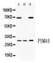 Proteasome Subunit Alpha 4 antibody, PB10090, Boster Biological Technology, Western Blot image 