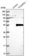 THUMP Domain Containing 1 antibody, NBP1-82194, Novus Biologicals, Western Blot image 