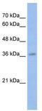 MYB Proto-Oncogene, Transcription Factor antibody, TA343534, Origene, Western Blot image 