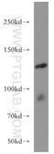 Rho/Rac Guanine Nucleotide Exchange Factor 18 antibody, 11243-1-AP, Proteintech Group, Western Blot image 