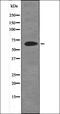 IL2 Inducible T Cell Kinase antibody, orb335740, Biorbyt, Western Blot image 