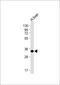 Glycine N-Methyltransferase antibody, M03562, Boster Biological Technology, Western Blot image 