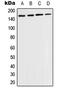 TEK Receptor Tyrosine Kinase antibody, MBS822235, MyBioSource, Western Blot image 