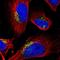 Golgin A2 antibody, HPA021178, Atlas Antibodies, Immunocytochemistry image 