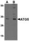 Autophagy Related 5 antibody, TA306727, Origene, Western Blot image 