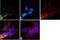 Leucine Rich Repeat Kinase 2 antibody, 701066, Invitrogen Antibodies, Immunofluorescence image 