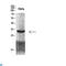 Cyclin Dependent Kinase 6 antibody, LS-C813815, Lifespan Biosciences, Western Blot image 