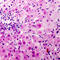 Centriolar Coiled-Coil Protein 110 antibody, LS-C354576, Lifespan Biosciences, Immunohistochemistry paraffin image 