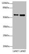 Signal Transducing Adaptor Molecule 2 antibody, LS-C676548, Lifespan Biosciences, Western Blot image 