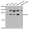 Core-Binding Factor Subunit Beta antibody, abx004055, Abbexa, Western Blot image 