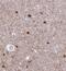 Alport Syndrome, Mental Retardation, Midface Hypoplasia And Elliptocytosis Chromosomal Region Gene 1 antibody, FNab00364, FineTest, Immunohistochemistry frozen image 