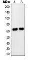 Paired Box 8 antibody, LS-C353030, Lifespan Biosciences, Western Blot image 