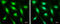 MDM2 Proto-Oncogene antibody, GTX100654, GeneTex, Immunofluorescence image 