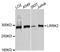 Leucine Rich Repeat Kinase 2 antibody, abx126964, Abbexa, Western Blot image 
