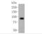 Fibroblast Activation Protein Alpha antibody, NBP2-66844, Novus Biologicals, Western Blot image 