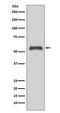Caspase 8 antibody, M00042, Boster Biological Technology, Western Blot image 