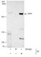 Tet Methylcytosine Dioxygenase 1 antibody, MA5-16312, Invitrogen Antibodies, Immunoprecipitation image 