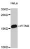Interferon Induced Transmembrane Protein 3 antibody, A13070, ABclonal Technology, Western Blot image 
