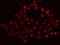 RNA Binding Motif Protein 14 antibody, GTX02191, GeneTex, Immunofluorescence image 