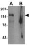 Small G Protein Signaling Modulator 2 antibody, GTX32094, GeneTex, Western Blot image 