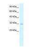 Claudin 15 antibody, NBP1-59149, Novus Biologicals, Western Blot image 