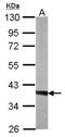 Twinfilin Actin Binding Protein 1 antibody, NBP1-33132, Novus Biologicals, Western Blot image 