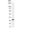 Synaptosome Associated Protein 25 antibody, R30373, NSJ Bioreagents, Western Blot image 