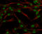 Transcription factor SOX-3 antibody, GTX129235, GeneTex, Immunocytochemistry image 