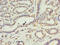 Death Associated Protein Kinase 2 antibody, LS-C369509, Lifespan Biosciences, Immunohistochemistry paraffin image 