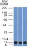 S100 Calcium Binding Protein A4 antibody, GTX34999, GeneTex, Western Blot image 