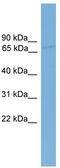 Sidekick Cell Adhesion Molecule 1 antibody, TA335931, Origene, Western Blot image 