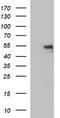 Interleukin 6 Receptor antibody, LS-C338222, Lifespan Biosciences, Western Blot image 