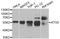 Autophagy Related 5 antibody, STJ22711, St John